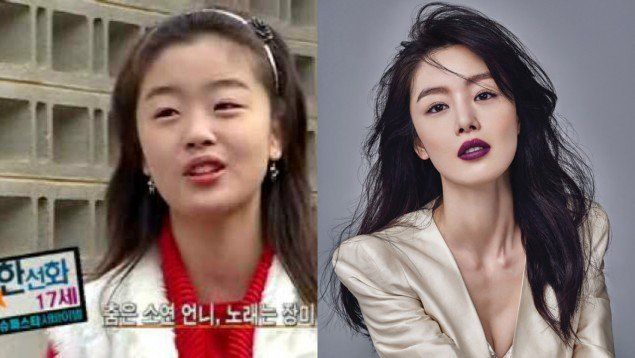 more korean stars who admitted to their surgeries and enhancements