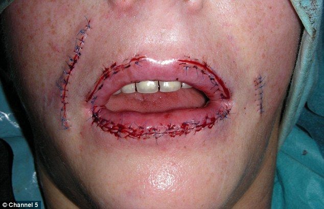 woman 41 left disfigured and covered in weeping sores woman 41 left disfigured and covered in weeping sores